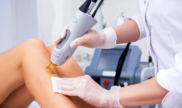 1581843253-What-is-the-best-laser-hair-removal-machine