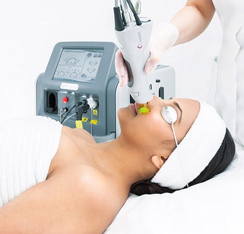 laser-hair-removal-500x480